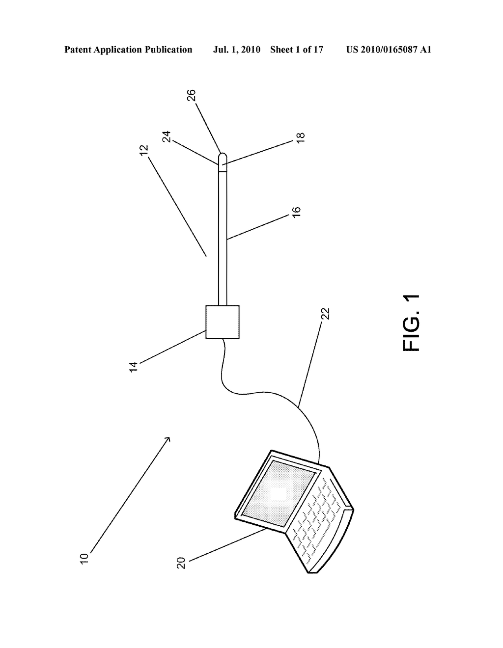 SYSTEM AND METHOD FOR MOSAICING ENDOSCOPE IMAGES CAPTURED FROM WITHIN A CAVITY - diagram, schematic, and image 02