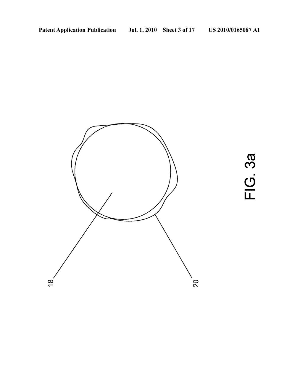 SYSTEM AND METHOD FOR MOSAICING ENDOSCOPE IMAGES CAPTURED FROM WITHIN A CAVITY - diagram, schematic, and image 04