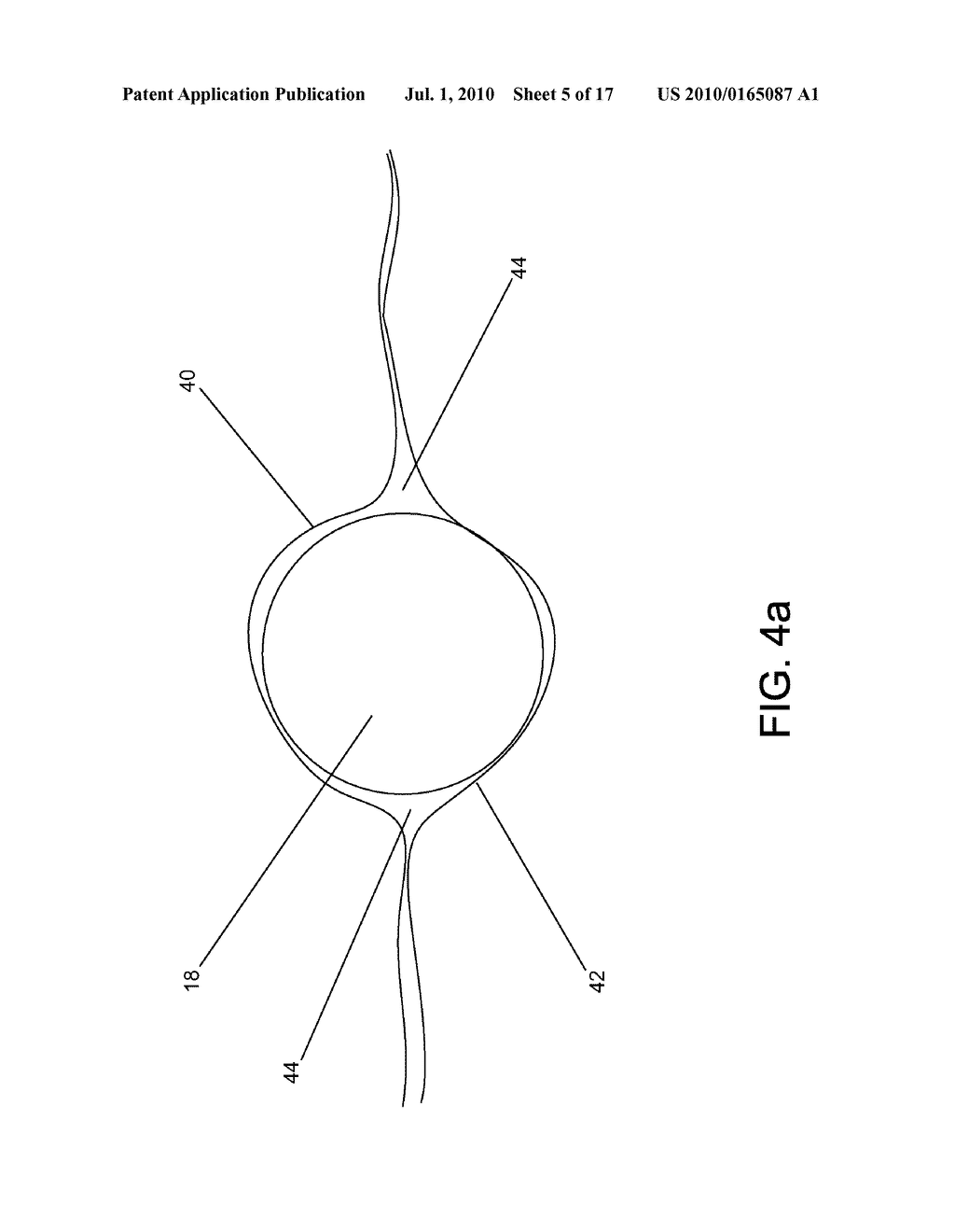 SYSTEM AND METHOD FOR MOSAICING ENDOSCOPE IMAGES CAPTURED FROM WITHIN A CAVITY - diagram, schematic, and image 06