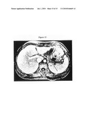 METHODS OF IMAGING INFLAMMATION IN PANCREATIC ISLETS diagram and image