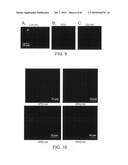 Gammaretrovirus associated with cancer diagram and image