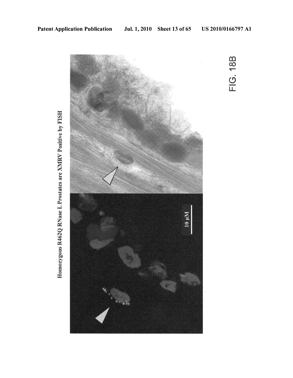 Gammaretrovirus associated with cancer - diagram, schematic, and image 14