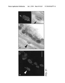 Gammaretrovirus associated with cancer diagram and image