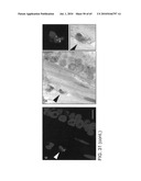 Gammaretrovirus associated with cancer diagram and image