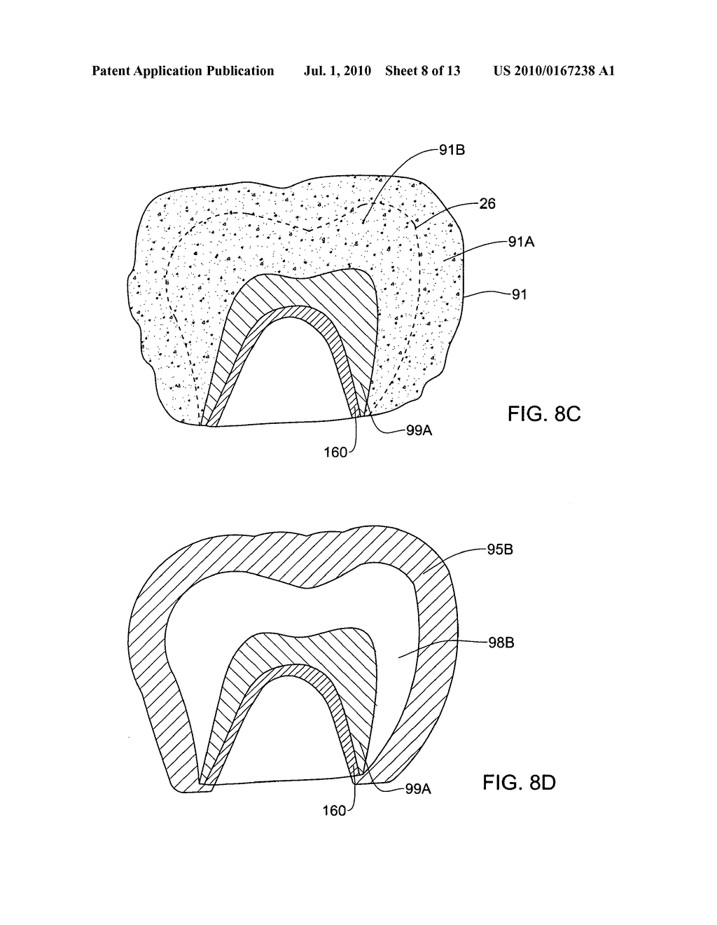 System and method for manufacturing a dental prosthesis and a dental prosthesis manufactured thereby - diagram, schematic, and image 09
