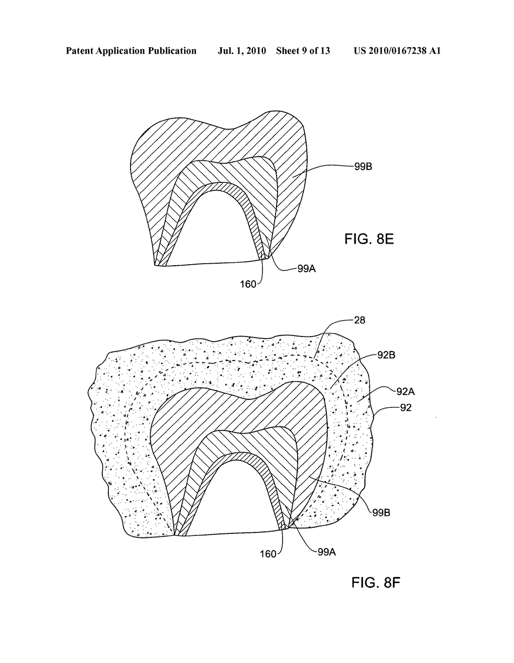 System and method for manufacturing a dental prosthesis and a dental prosthesis manufactured thereby - diagram, schematic, and image 10