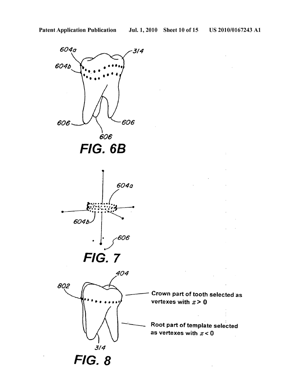 SYSTEM AND METHOD FOR AUTOMATIC CONSTRUCTION OF REALISTIC LOOKING TOOTH ROOTS - diagram, schematic, and image 11