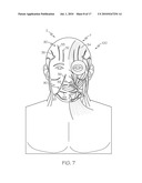 CUTANEOUS SURGICAL TRAINING MODEL OF THE HEAD, NECK AND SHOULDERS diagram and image