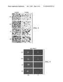 APPARATUS AND METHOD FOR THE PRESERVATION OF PANCREATIC TISSUE AND ISLET CELLS FOR TRANSPLANTATION diagram and image