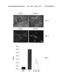 Stroke-generated angiogenesis enhancers and uses thereof diagram and image