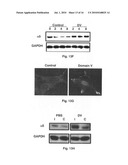 Stroke-generated angiogenesis enhancers and uses thereof diagram and image