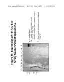 NUCLEIC ACID AND CORRESPONDING PROTEIN ENTITLED 151P3D4 USEFUL IN TREATMENT AND DETECTION OF CANCER diagram and image