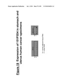 NUCLEIC ACID AND CORRESPONDING PROTEIN ENTITLED 151P3D4 USEFUL IN TREATMENT AND DETECTION OF CANCER diagram and image