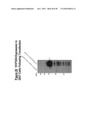 NUCLEIC ACID AND CORRESPONDING PROTEIN ENTITLED 151P3D4 USEFUL IN TREATMENT AND DETECTION OF CANCER diagram and image