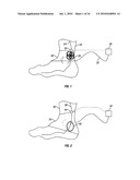 METHOD AND APPARATUS FOR MAGNETIC INDUCTION THERAPY diagram and image