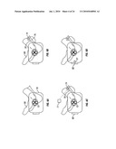 METHOD AND APPARATUS FOR MAGNETIC INDUCTION THERAPY diagram and image