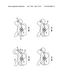 METHOD AND APPARATUS FOR MAGNETIC INDUCTION THERAPY diagram and image