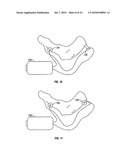 METHOD AND APPARATUS FOR MAGNETIC INDUCTION THERAPY diagram and image