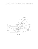 METHOD AND APPARATUS FOR MAGNETIC INDUCTION THERAPY diagram and image