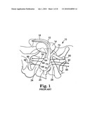 METHODS AND APPARATUS FOR SECURING A URETHRAL SLING TO A PUBIC BONE diagram and image