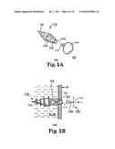 METHODS AND APPARATUS FOR SECURING A URETHRAL SLING TO A PUBIC BONE diagram and image