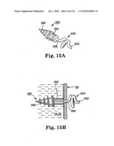 METHODS AND APPARATUS FOR SECURING A URETHRAL SLING TO A PUBIC BONE diagram and image