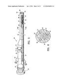 ENDOSCOPIC DELIVERY OF MEDICAL DEVICES diagram and image