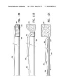 ENDOSCOPIC DELIVERY OF MEDICAL DEVICES diagram and image