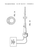 ENDOSCOPIC DELIVERY OF MEDICAL DEVICES diagram and image