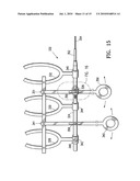 ENDOSCOPIC DELIVERY OF MEDICAL DEVICES diagram and image