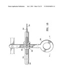 ENDOSCOPIC DELIVERY OF MEDICAL DEVICES diagram and image