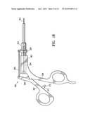 ENDOSCOPIC DELIVERY OF MEDICAL DEVICES diagram and image