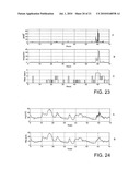 METHOD AND/OR SYSTEM FOR SENSOR ARTIFACT FILTERING diagram and image