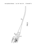 PERIPHERAL ULTRASOUND DEVICE diagram and image