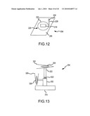 PERIPHERAL ULTRASOUND DEVICE diagram and image