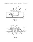 PERIPHERAL ULTRASOUND DEVICE diagram and image