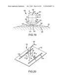 PERIPHERAL ULTRASOUND DEVICE diagram and image