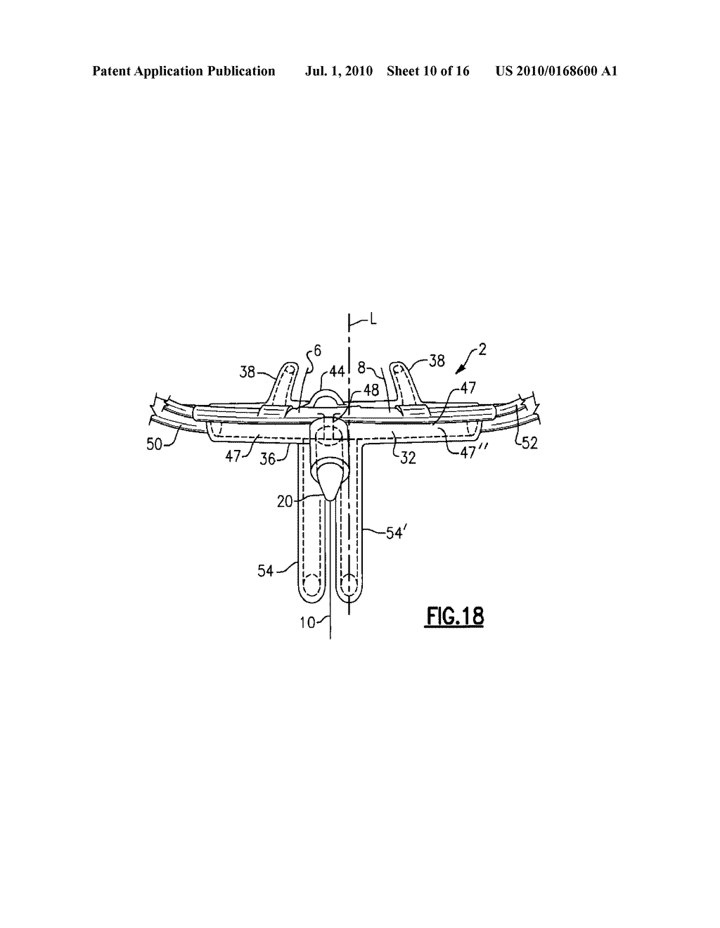 SUPPORT STRUCTURE FOR AIRFLOW TEMPERATURE SENSOR AND THE METHOD OF USING THE SAME - diagram, schematic, and image 11