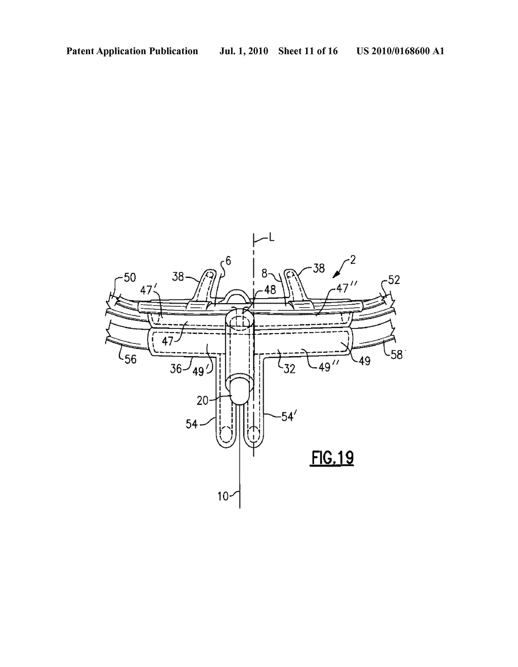SUPPORT STRUCTURE FOR AIRFLOW TEMPERATURE SENSOR AND THE METHOD OF USING THE SAME - diagram, schematic, and image 12