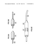 MICROVASCULAR OBSTRUCTION DETECTION AND THERAPY diagram and image