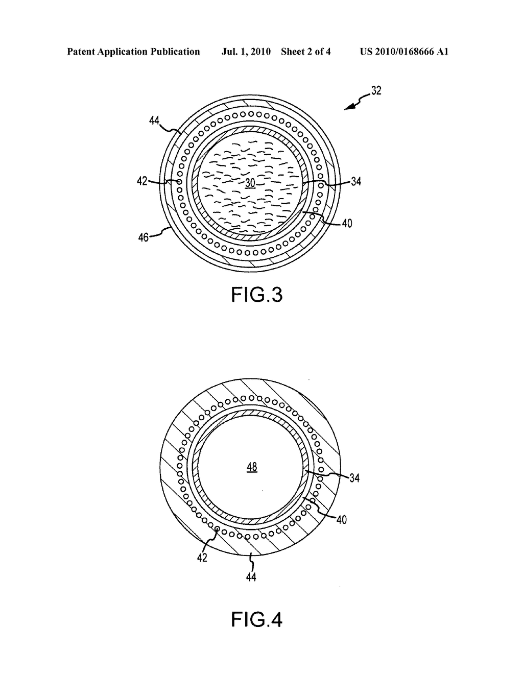 Catheter Having Independently-Deflectable Segments and Method of its Manufacture - diagram, schematic, and image 03