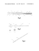 Balloon Catheter diagram and image