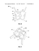 CATHETER CLAMPING ASSEMBLIES diagram and image