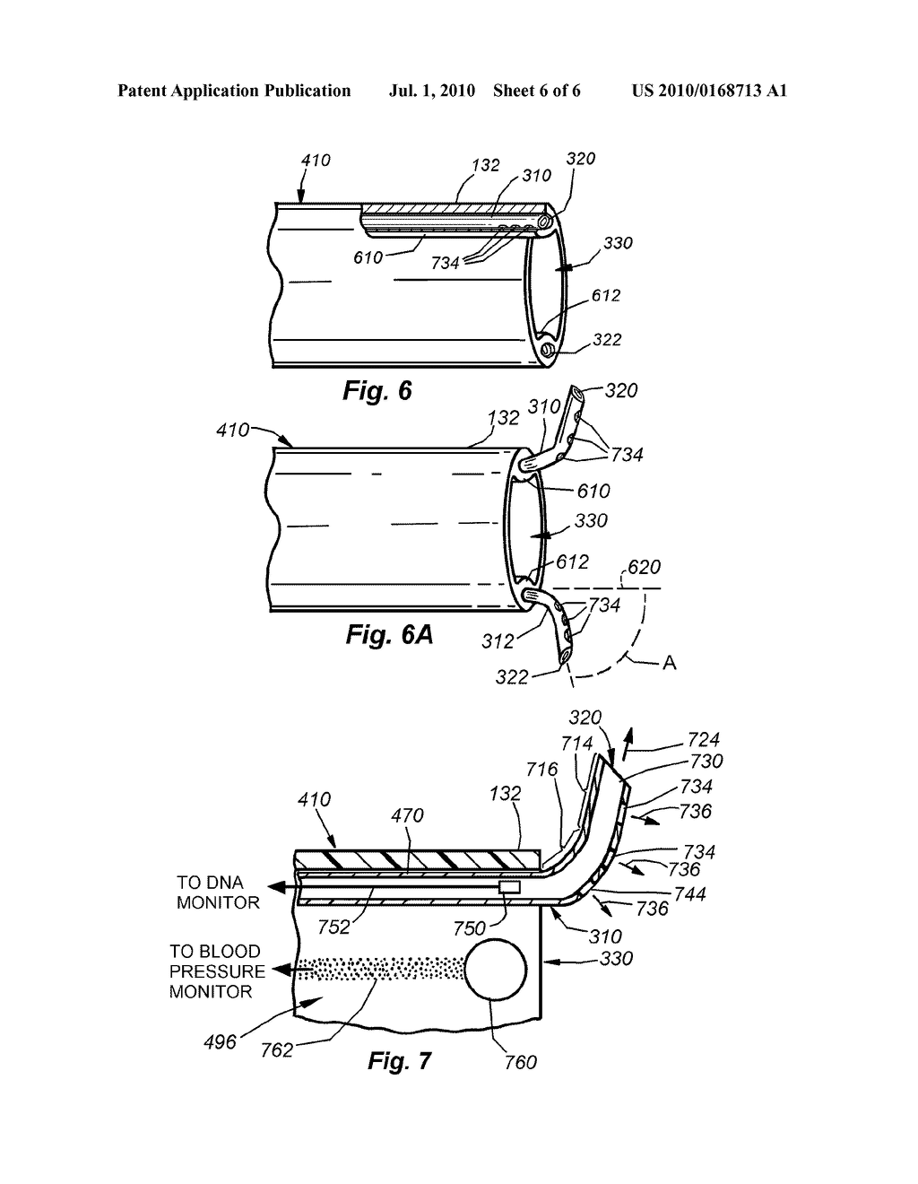 CATHETER FOR INTRODUCTION OF MEDICATIONS TO THE TISSUES OF A HEART OR OTHER ORGAN - diagram, schematic, and image 07