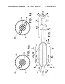 THERAPEUTIC AGENT DELIVERY SYSTEM diagram and image