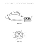 Tuned RF energy for selective treatment of atheroma and other target tissues and/or structures diagram and image