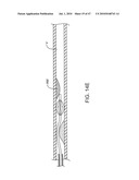 Tuned RF energy for selective treatment of atheroma and other target tissues and/or structures diagram and image