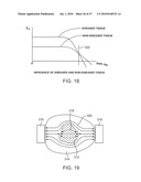 Tuned RF energy for selective treatment of atheroma and other target tissues and/or structures diagram and image