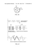 Tuned RF energy for selective treatment of atheroma and other target tissues and/or structures diagram and image