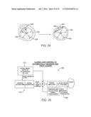 Tuned RF energy for selective treatment of atheroma and other target tissues and/or structures diagram and image